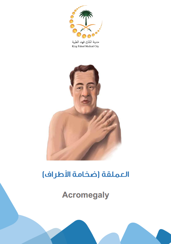 acromegaly.PNG
