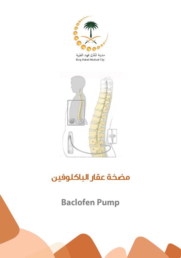 Baclofen Pump.PNG