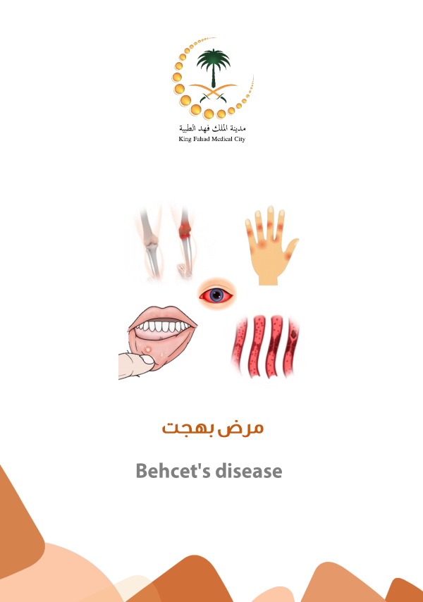 Behcets disease.PNG