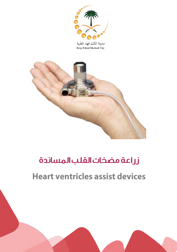 heart ventrical assist devices.PNG