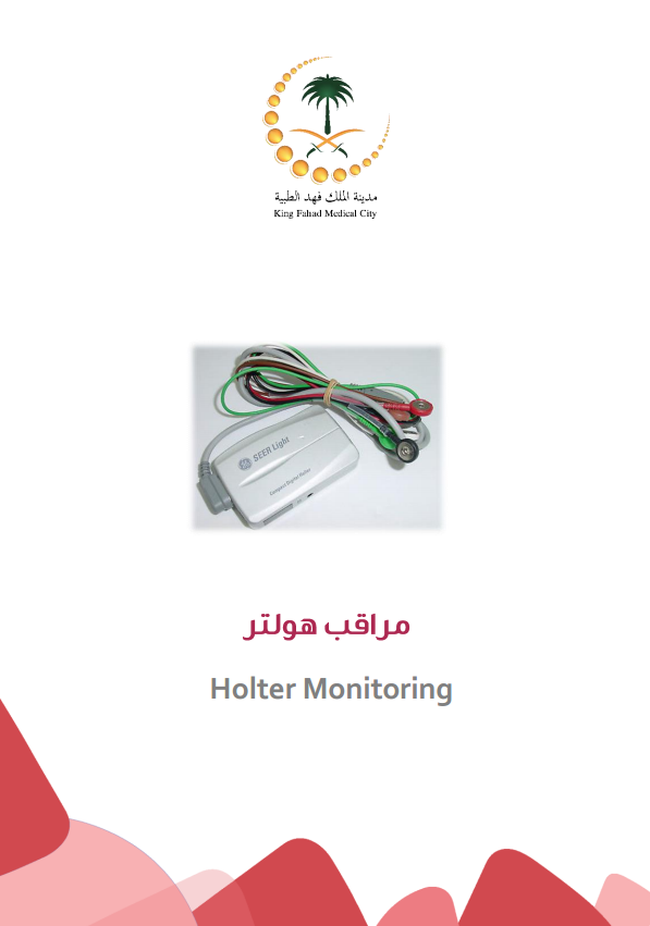 holter monitoring.PNG
