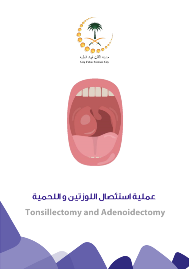 tonsillectomy and adenoidectomy.PNG