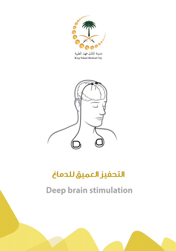 Deep brain stimulation.PNG