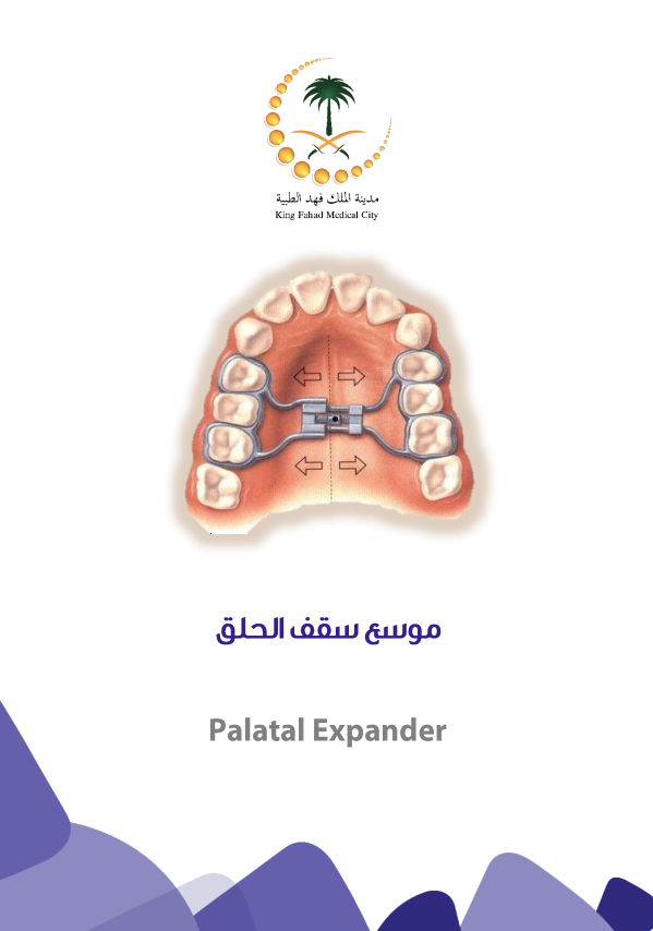 palatal expander AR.PNG