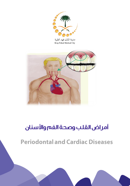 periodontal cardiac diseases.PNG