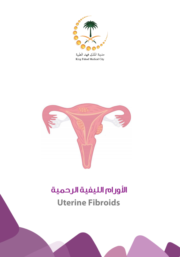 Uterine fibroids.PNG