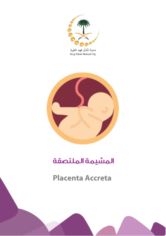 placenta accreta.PNG