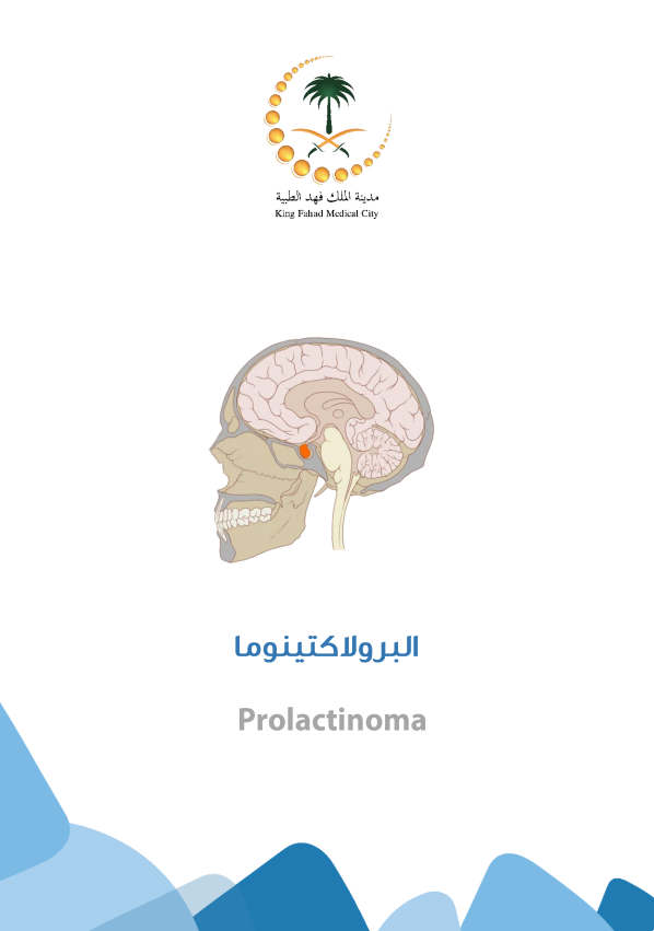 prolactinoma.PNG