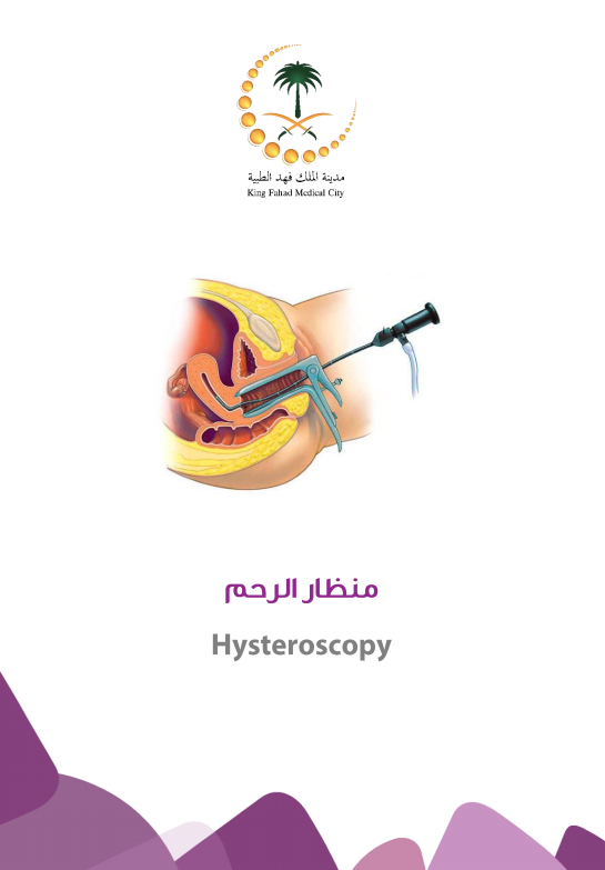 Hysteroscopy.PNG