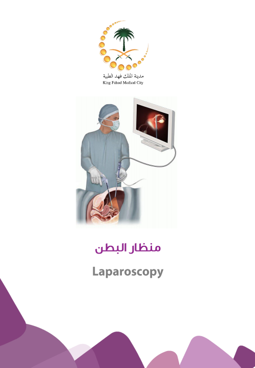 laparoscopy.PNG