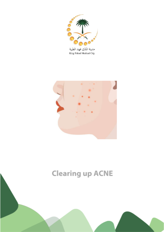 clearning up ACNE.PNG