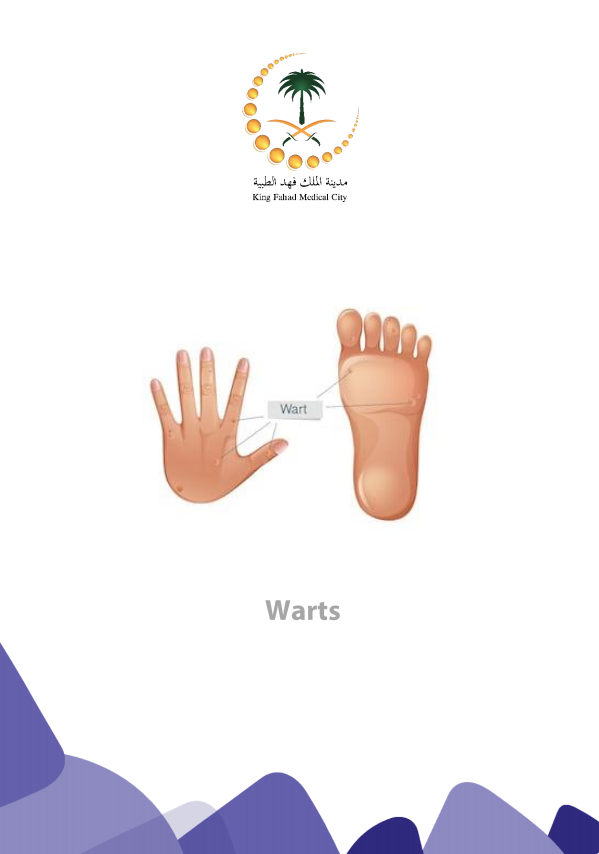 warts.PNG