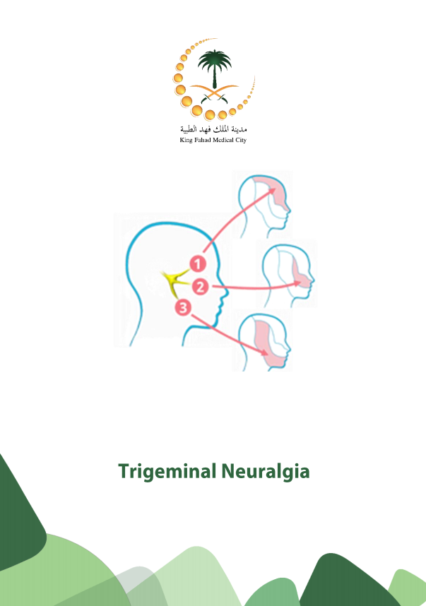 trigeminal neuralgia.PNG