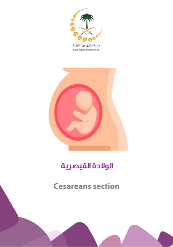 cesareans sections1.PNG