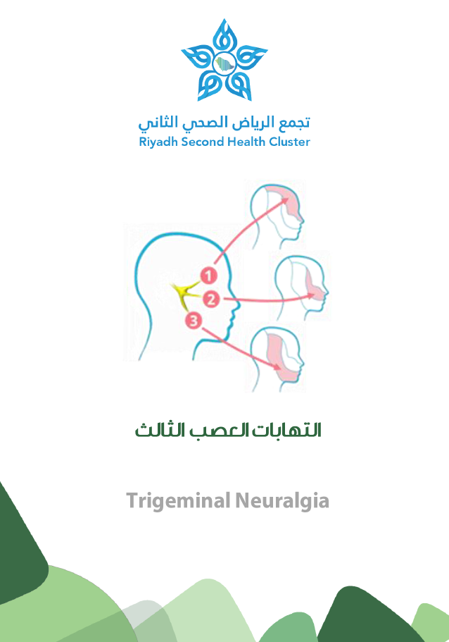 Trigeminal Neuralgia.PNG