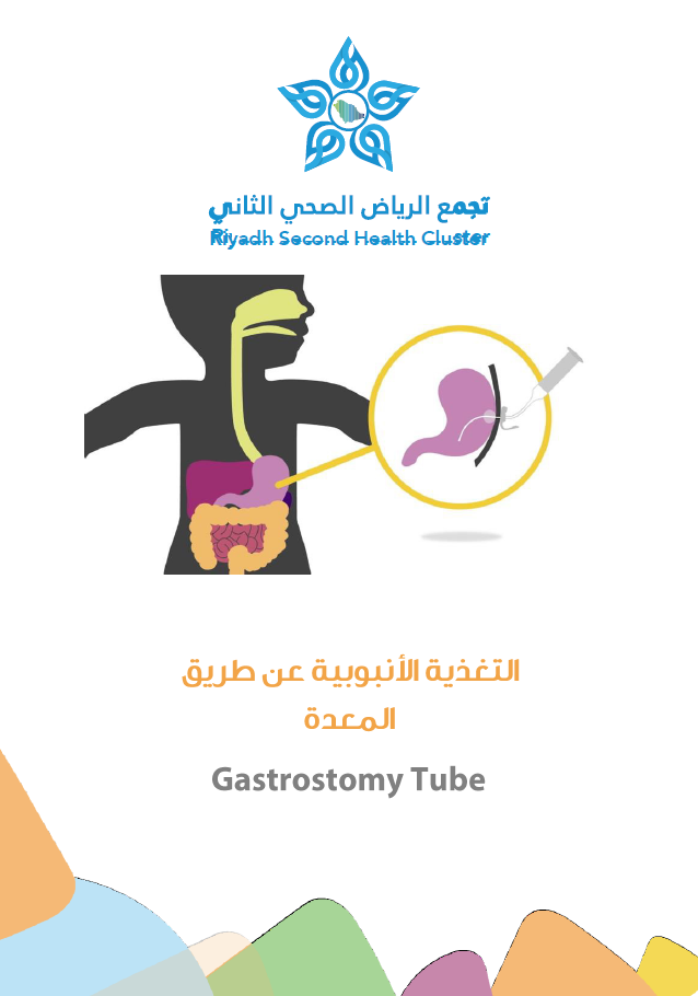 gastrostomy tube AR.PNG