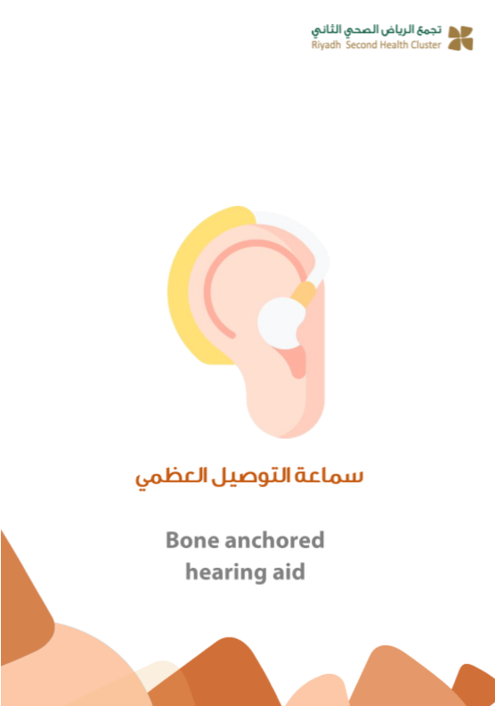 bone anchored hearing aid.PNG